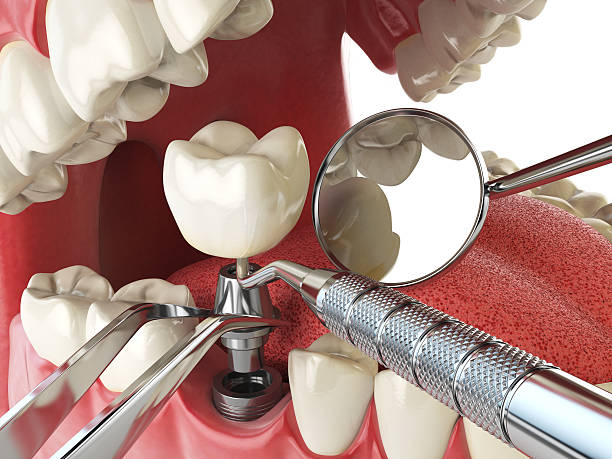 Best Emergency Denture Repair in Cape May Court House, NJ